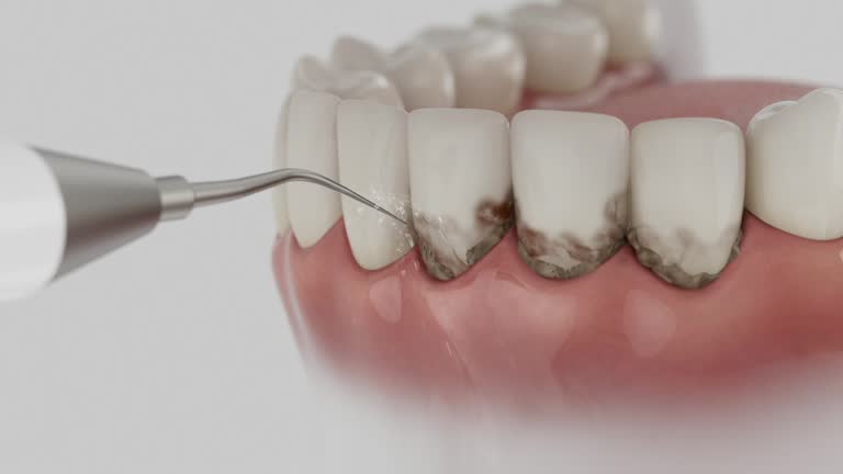 Reliable Dental Implants contractor in Thomas, OK by Smile Center Dentistry